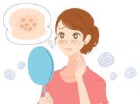 顔を洗いすぎると「ニキビ」ができる？という雑学