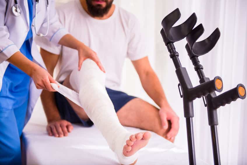 単純骨折と複雑骨折の違いは、骨が皮膚を破っているかどうかというトリビア