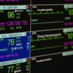 心電図の電極ってなぜ足にもつけるの？という雑学