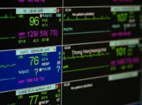 心電図の電極ってなぜ足にもつけるの？という雑学