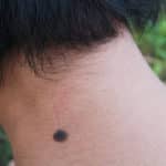 ホクロに生えた毛が太くて濃い理由に関する雑学